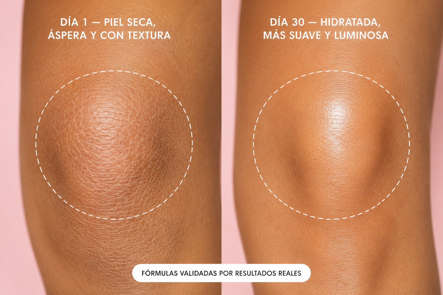Aceite Íntimo Aclarante Truly Rosado — Transforma tu Piel en 2 Semanas ✨ Bikini, Entrepiernas & Axilas