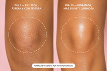 Aceite Íntimo Aclarante Truly Rosado — Transforma tu Piel en 2 Semanas ✨ Bikini, Entrepiernas & Axilas