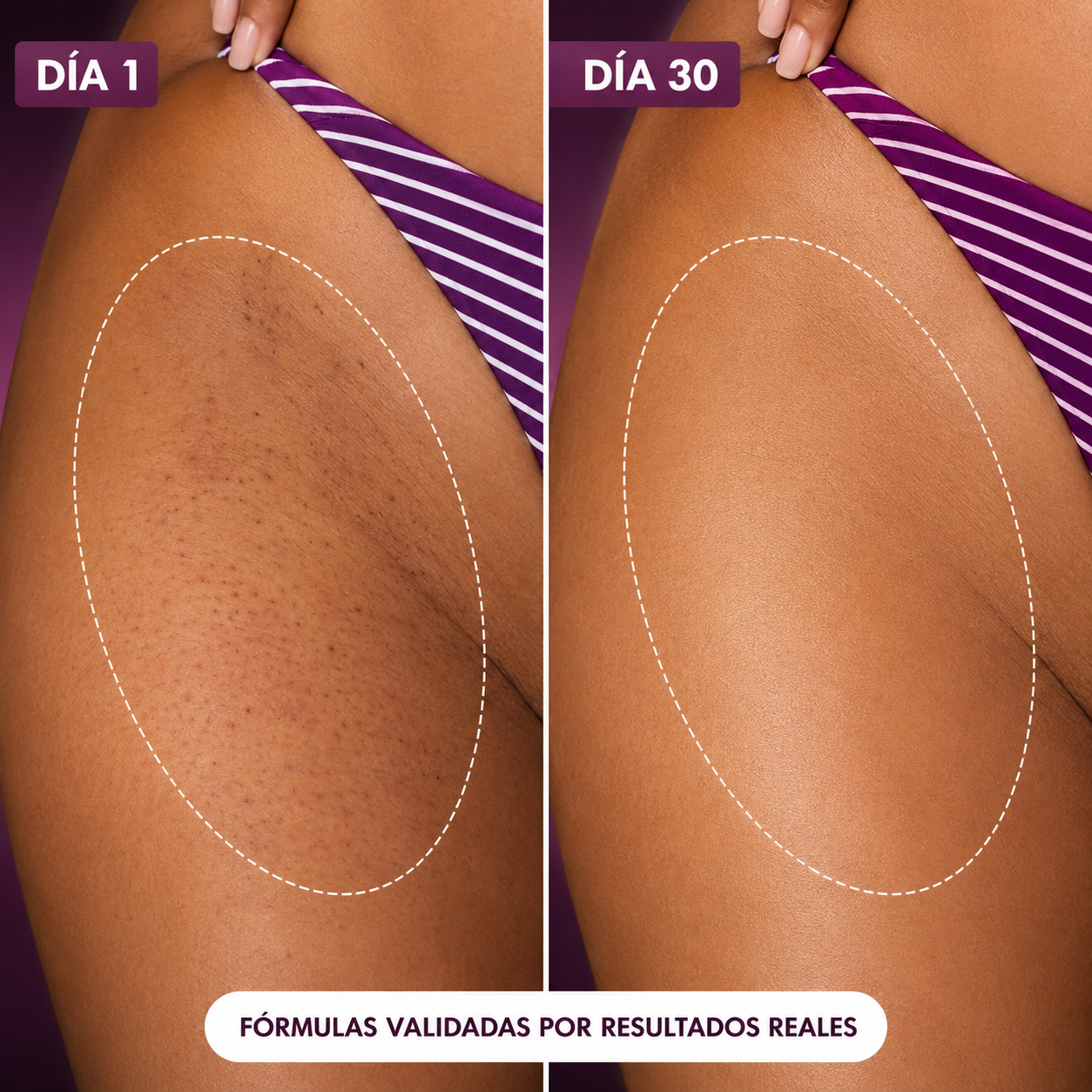 Aceite Truly Glazed Donut — Hidrata, Suaviza y Elimina  los Vellos Enquistados desde el Primer Uso 🍩✨  Piel Sedosa Garantizada